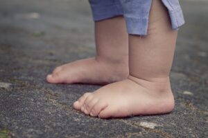 common foot problems in children