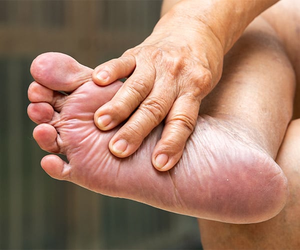 Diabetes and Your Feet
